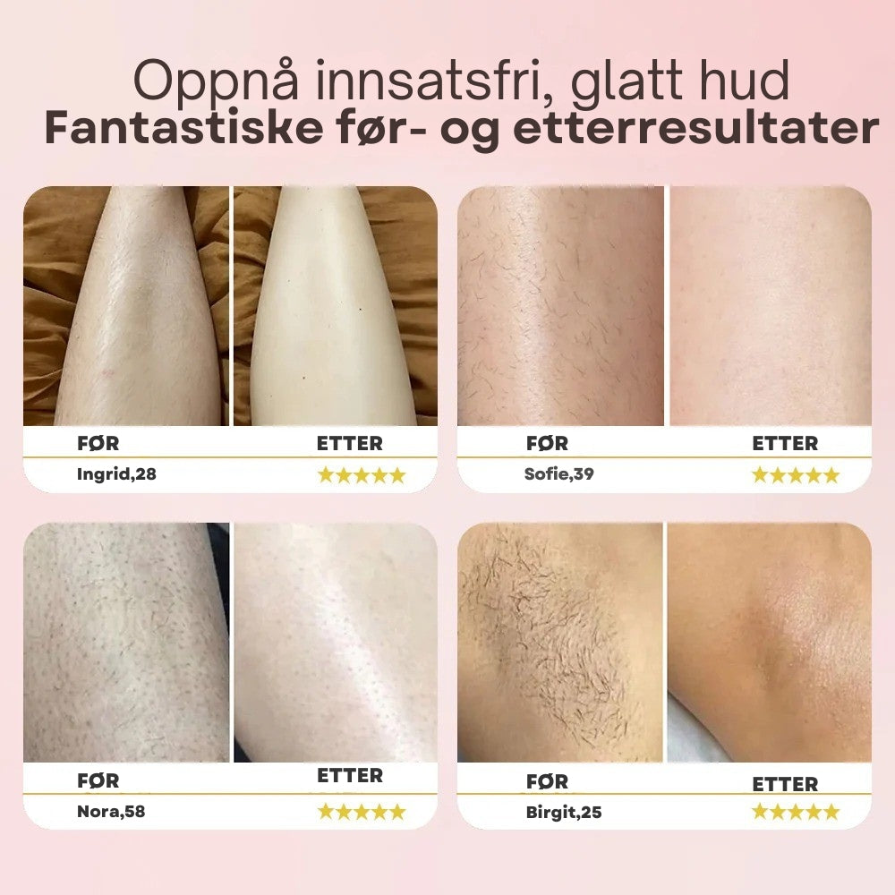 Dermave™ Trimmer 2.0